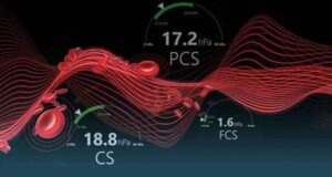 QPlus® Cartridge & QStat® Cartridge | HemoSonics